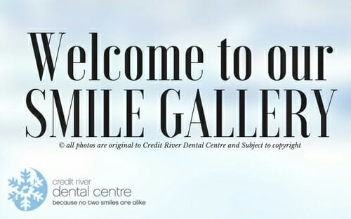 smile-gallery