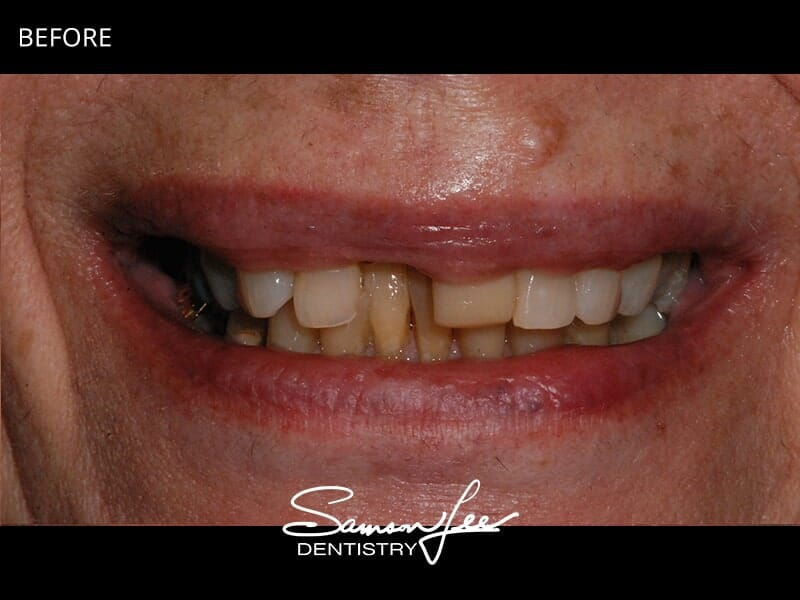 Before smile makeover