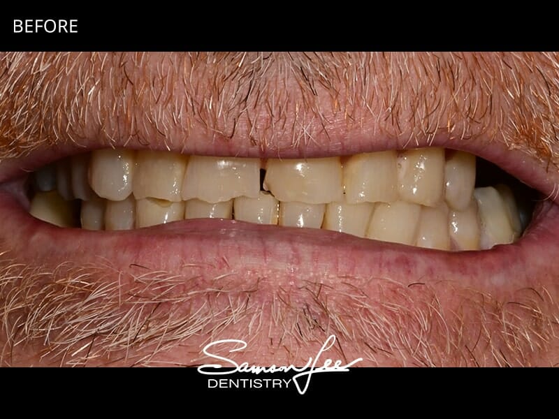 Before smile makeover close-up
