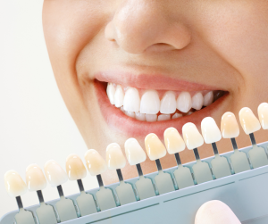 Teeth Whitening